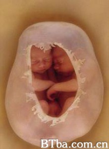 子宫日记：多胞胎 子宫日记：同卵双胞胎 In The Womb-Identical Twins (1970)  BT磁力 迅雷网盘下载