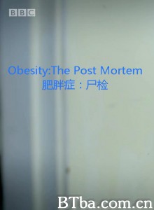 肥胖症：尸检 Obesity The Post Mortem (2016) 720P BT磁力 迅雷网盘下载