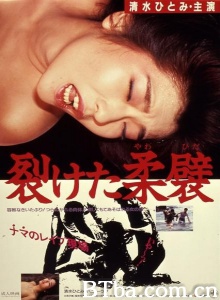 裂けた柔襞