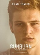 晒伤/Sunburn