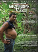 人体器官交易实录/Tales from the Organ Trade‎