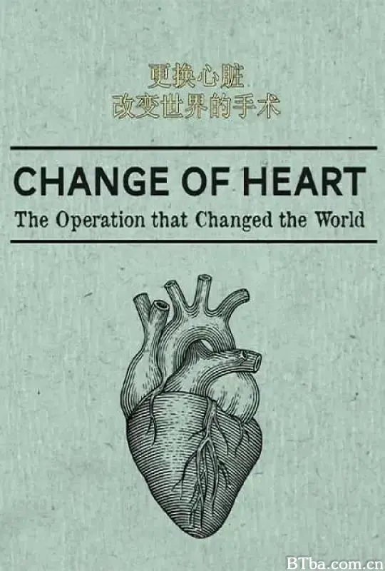 更换心脏：改变世界的手术/Change of  Heart: The Operation that Changed the World