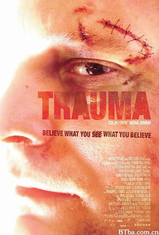 创伤/Trauma