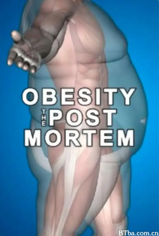解剖肥胖/Obesity: The Post Mortem
