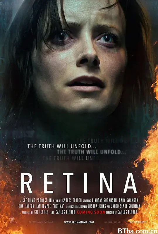 视网膜/Retina